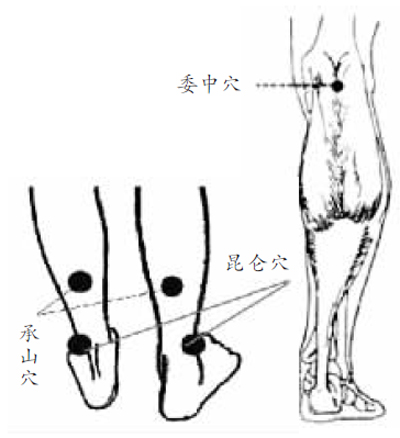 每个人身上的三个排湿口