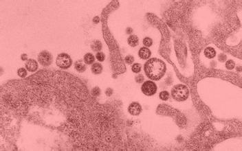 索命病毒——埃博拉传染性最强吗？
